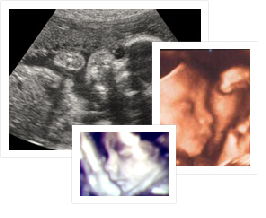 Как выглядят 26 недели беременности. УЗИ 26 недель беременности. УЗИ плода на 26 неделе беременности. Снимки УЗИ на 26 неделе беременности.