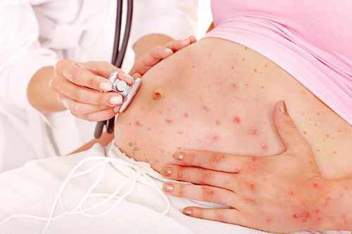 Можно ли ставить прививку от гепатита при планировании беременности thumbnail