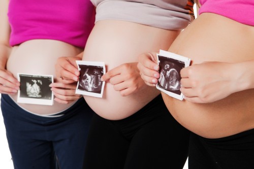 Close up of group pregnant women holding ultrasound scan on her tummy