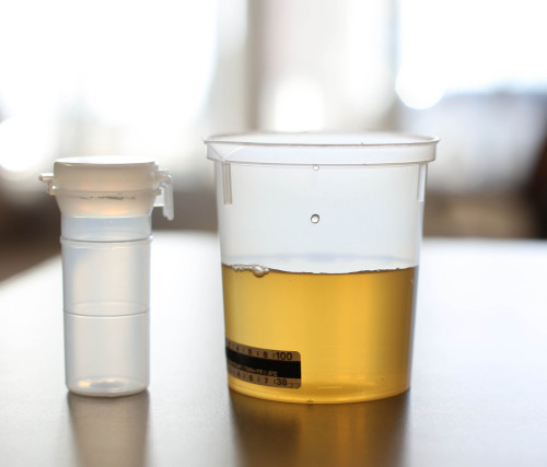 urine-drug-test-specimen
