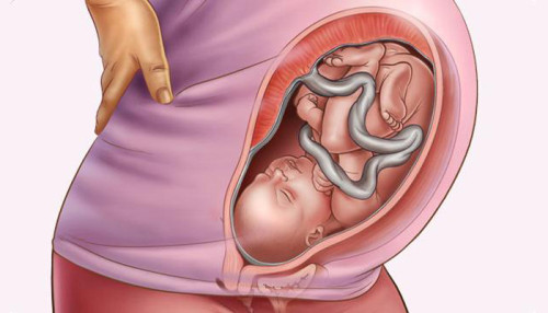 Коленно локтевая позиция при беременности противопоказания thumbnail