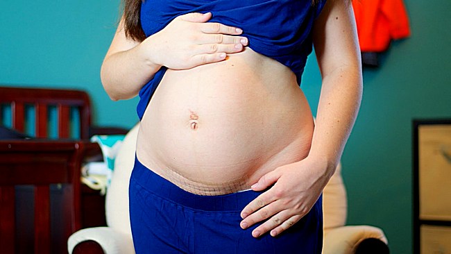 Особенности беременности при рубцах на матке