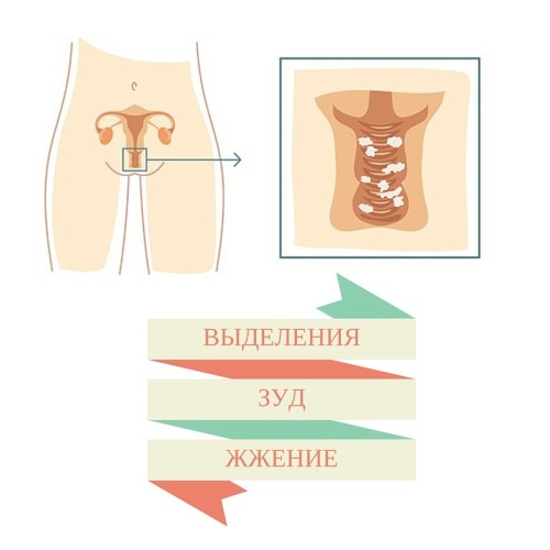 Клотримазол мазь инструкция по применению для женщин при беременности thumbnail