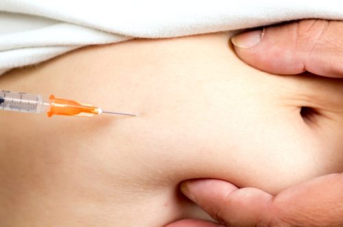 Как правильно колоть клексан в живот при беременности thumbnail