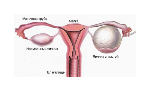 Болит правый бок внизу живота у женщины при беременности на поздних сроках thumbnail