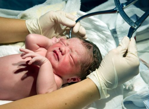 ARCHIV - Ein Säugling wird kurz nach seiner Geburt im Klinikum in Frankfurt (Oder) gemessen, aufgenommen am 23.06.2010. Experten haben ein obligatorische Untersuchung von Neugeborenen auf die Stoffwechselkrankheit Mukoviszidose gefordert. Foto: Patrick Pleul dpa (zu dpa 0466 vom 30.06.2012) +++(c) dpa - Bildfunk+++