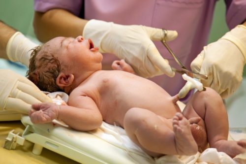 New born baby being treated just after the birth