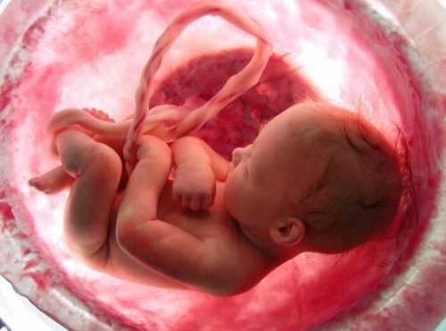 Последствия нарушение кровотока при беременности последствия для ребенка thumbnail