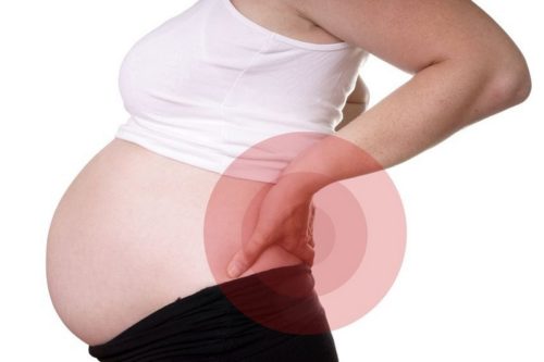 Защемление нерва в пояснице при беременности симптомы thumbnail