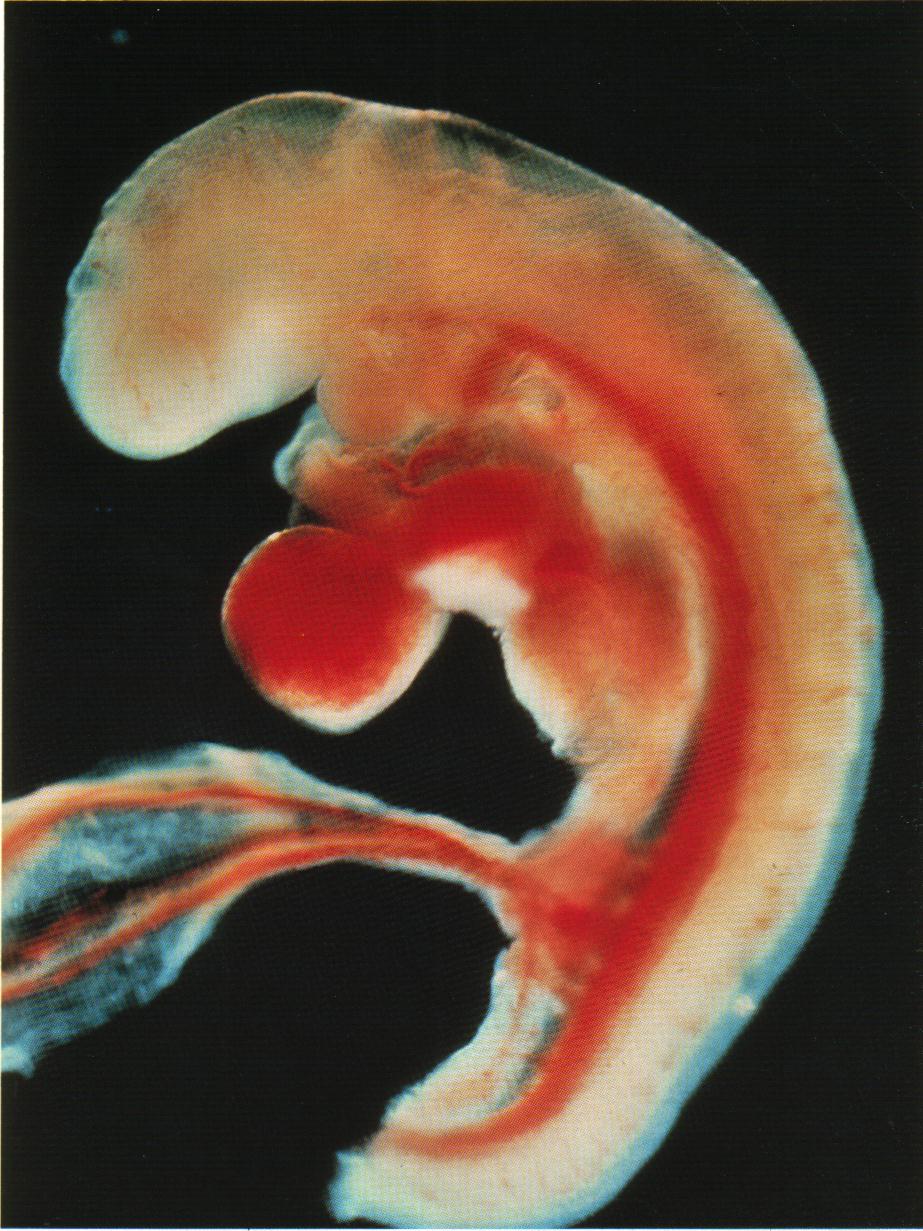 Через четыре недели. Зародыш на 4 неделе беременности. Плод 3-4 недели беременности. Зародыш 4 недели беременности фото плода. Юбрион в 4 недели беременности.