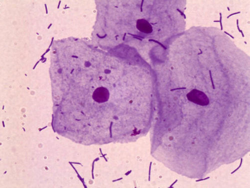 Лейкоциты в мазке у женщин при беременности норма thumbnail