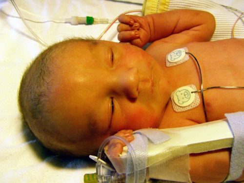 Как понять что у ребенка гипоксия во время беременности