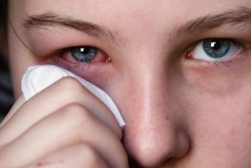 Как лечить воспаление глаза при беременности