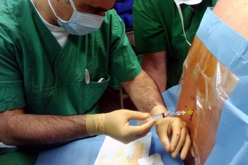 Эпидуральная анестезия в родах показания и противопоказания