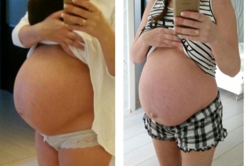 На каком месяце беременности живот опускается