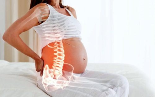 Грыжа во время беременности симптомы
