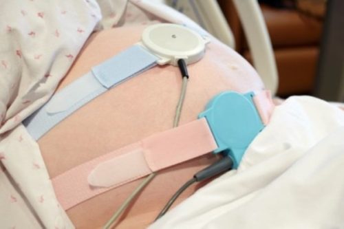 Что такое экг при беременности и как его делают