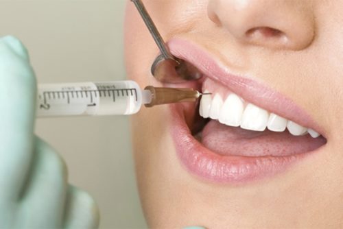 Ультракаин при лечении зуба беременной