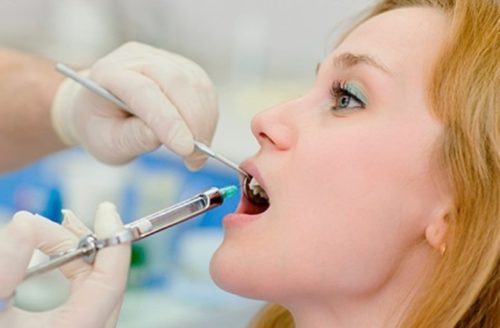 Беременность лечение зубов ультракаин