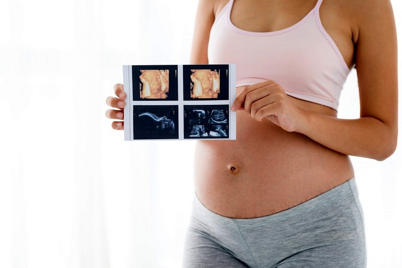 Что такое 3Д УЗИ при беременности, фото, отзывы, цены. Когда и на каком сроке лучше делать 3Д УЗИ при беременности