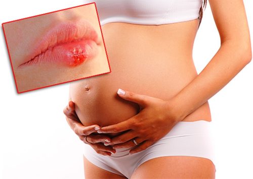 Панавир при беременности гель противопоказания