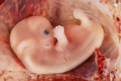 Низкий гемоглобин при ранней беременности