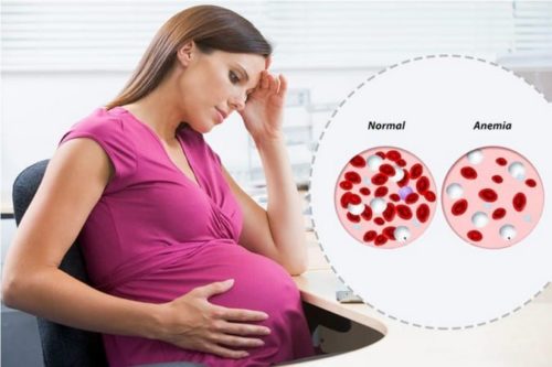 Пониженный гемоглобину беременных последствия