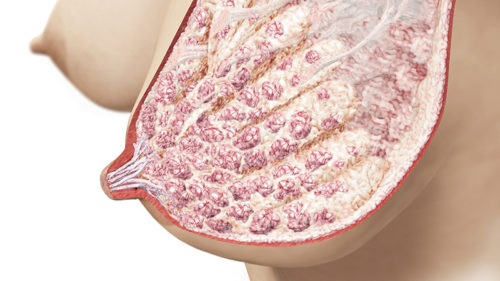 Колит в соске во время беременности