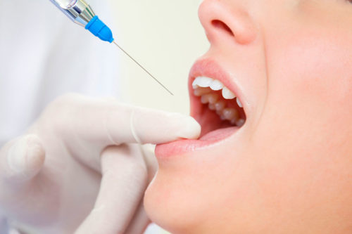 Лидокаин и беременность лечение зубов
