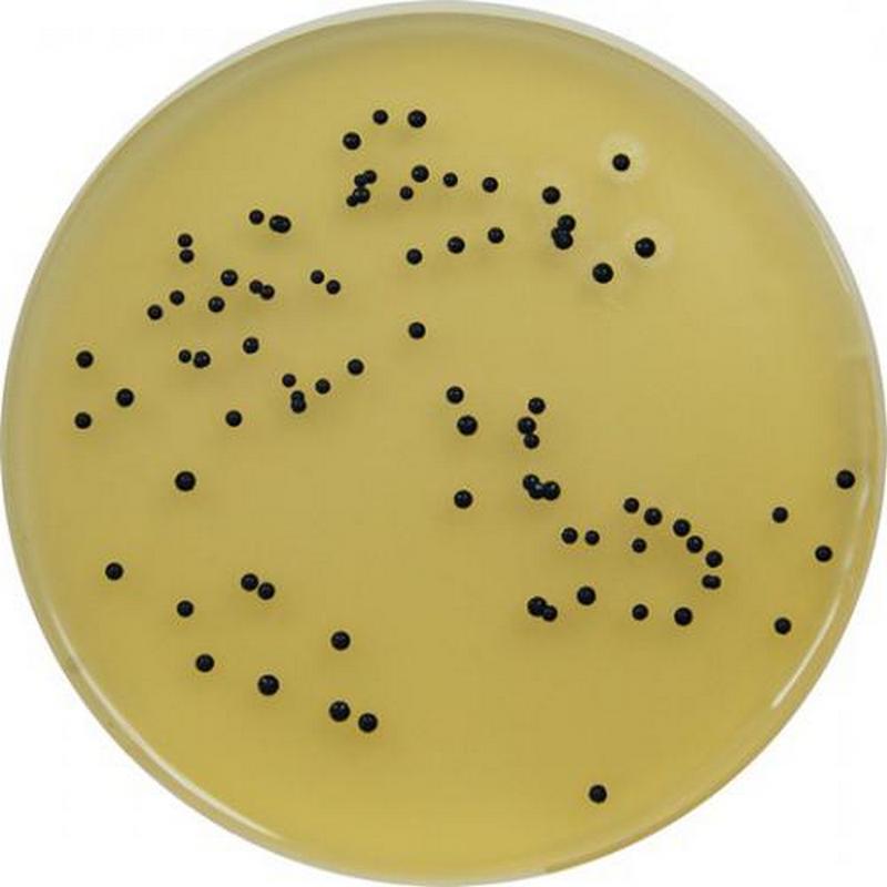 Staphylococcus aureus среда. Агар Байрд Паркера. Стафилококк на Байрд Паркера. Золотистый стафилококк на среде Байрд Паркера. Среда Байрд Паркера.