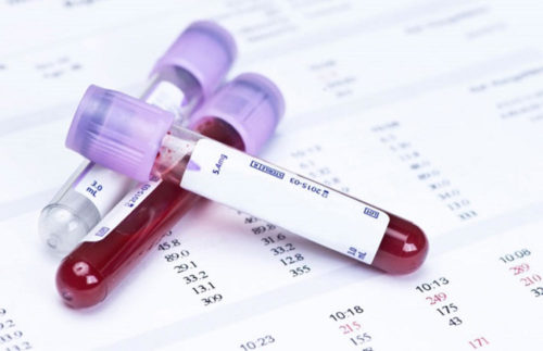 Палочкоядерные в анализе крови для беременных