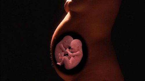 Удовлетворительное состояние мппк при беременности что это thumbnail