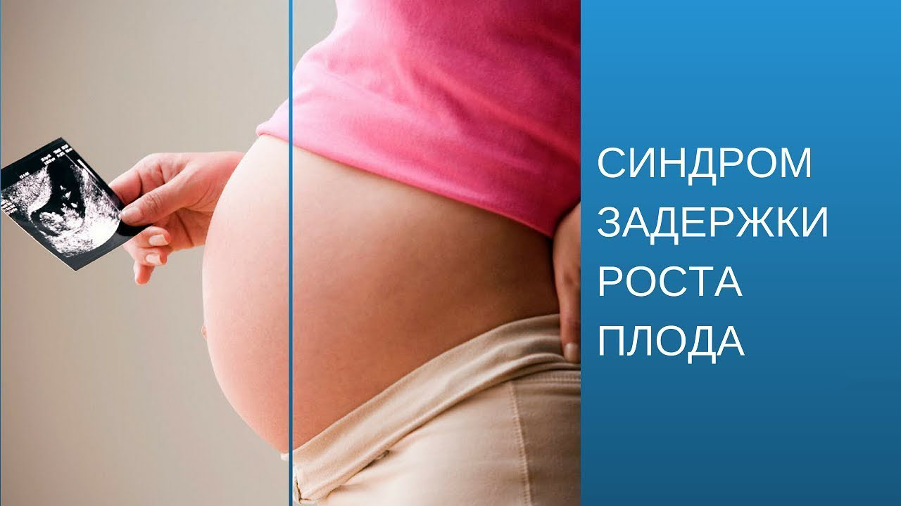 Что такое СЗРП при беременности. Степени СЗРП во время беременности. Лечение СЗРП при беременности