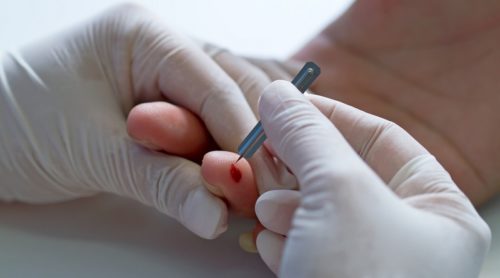 Палочки в крови у беременных норма