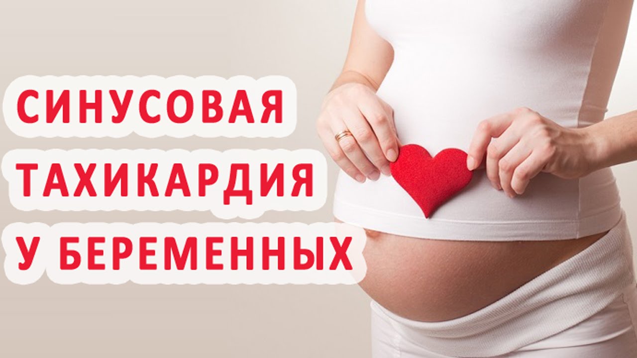 Синусовая тахикардия во время беременности: особенности ведения беременности. Как рожать при синусовой тахикардии сердца при беременности