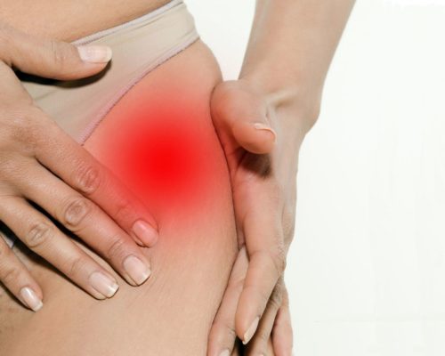 Болят мышцы выше колена при беременности
