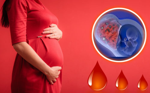Беременность после операции по удалению миомы матки